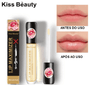 Lip Plump Soft® - Essential Store