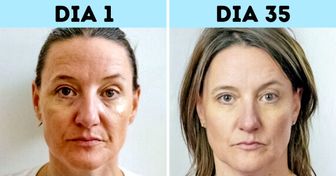 Combo Rejuvenescedor Ác. Hialurônico + Primer Vit C (FRETE GRÁTIS HOJE)