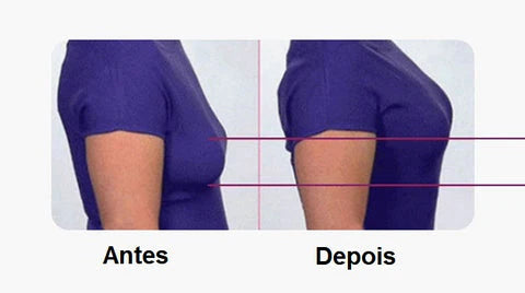 Sutiã SUSTENT POSTURE - (Último dia Promocional com Frete Grátis)
