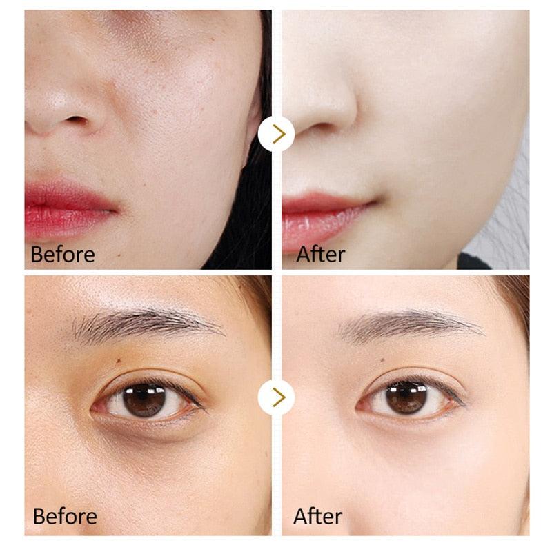 Anti-Aging de Ouro 24 K™️ ORIGINAL - Essential Store