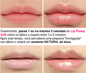 Lip Plump Soft® - Essential Store