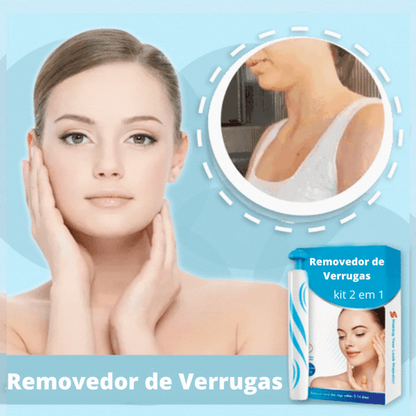 REMOVER PRO MAX® - Removedor de Verrugas (Promoção Relâmpago: 40% OFF SÓ HOJE!)