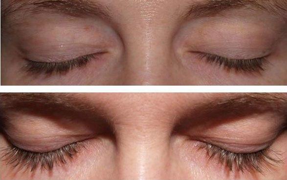 FAST LASHES™ - SÉRUM PARA CRESCIMENTO DE CÍLIOS E SOBRANCELHAS - Essential Store