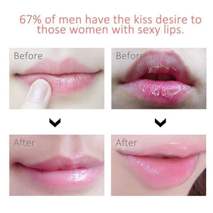 Lip Plump Soft® - Essential Store