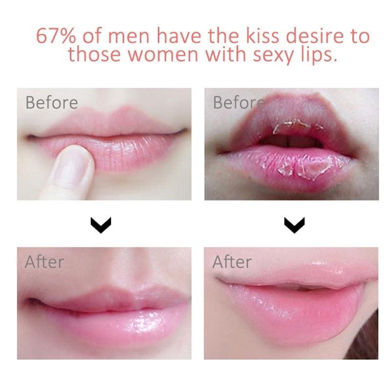Lip Plump Soft® - Essential Store