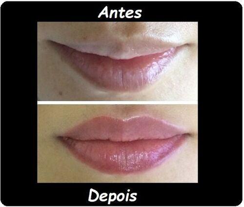 Lip Plump Soft® - Essential Store