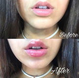 Lip Plump Soft® - Essential Store